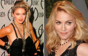 Madonna antes e depois Bichectomia