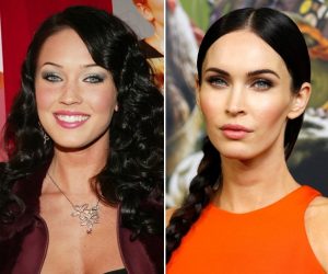 Atriz Megan Fox antes e depois Bichectomia