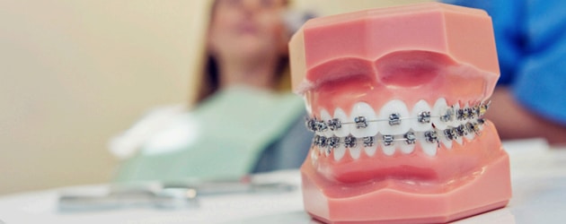 Aparelho ortodôntico deve ser usado antes do implante dental