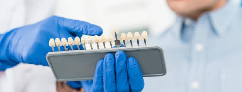 Existe rejeição de implantes dentários?