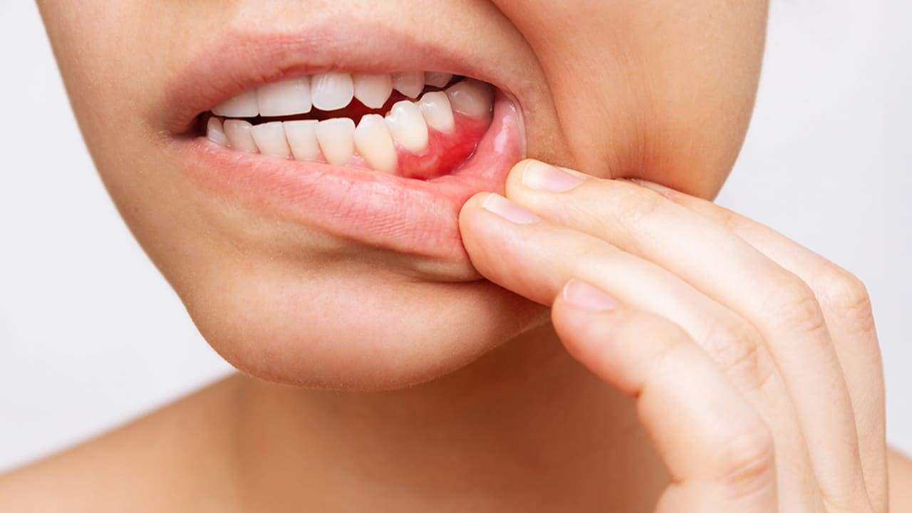 Periodontia - o que &eacute; e sua import&acirc;ncia para o sorriso