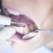 Dentist patient mouth dental exam